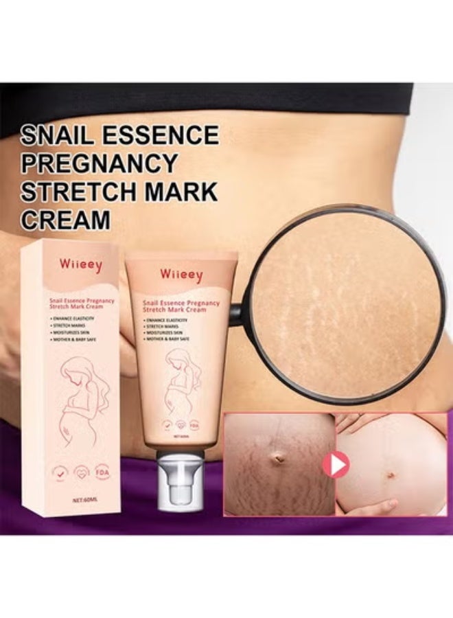 wiieey Snail Essence Pregnancy Stretch Mark Cream, Stretch Marks And Scar Removal Cream For Pregnancy, Stretch Marks Scar Belly Creams For Wrinkles, Obesity Fat Stretch Mark Moisturizing, Remove Marks - Image 2